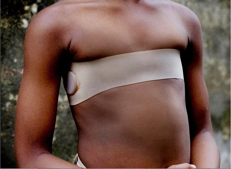 disadvantage of breast ironing
breast ironing documentary

breast ironing in england

breast ironing cameroon tagalog

united nations breast ironing
