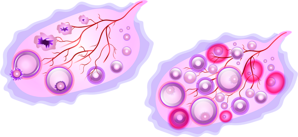 IUD (Intrauterine device)
Vasectomy
Tubal ligation
Emergency contraception
Natural family planning